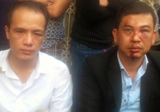 Hai luat su bi 8 trai lang danh muon gap tuong Chung hinh anh