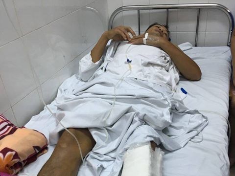 Vu mo nham chan: Cam thong hay phe phan? hinh anh