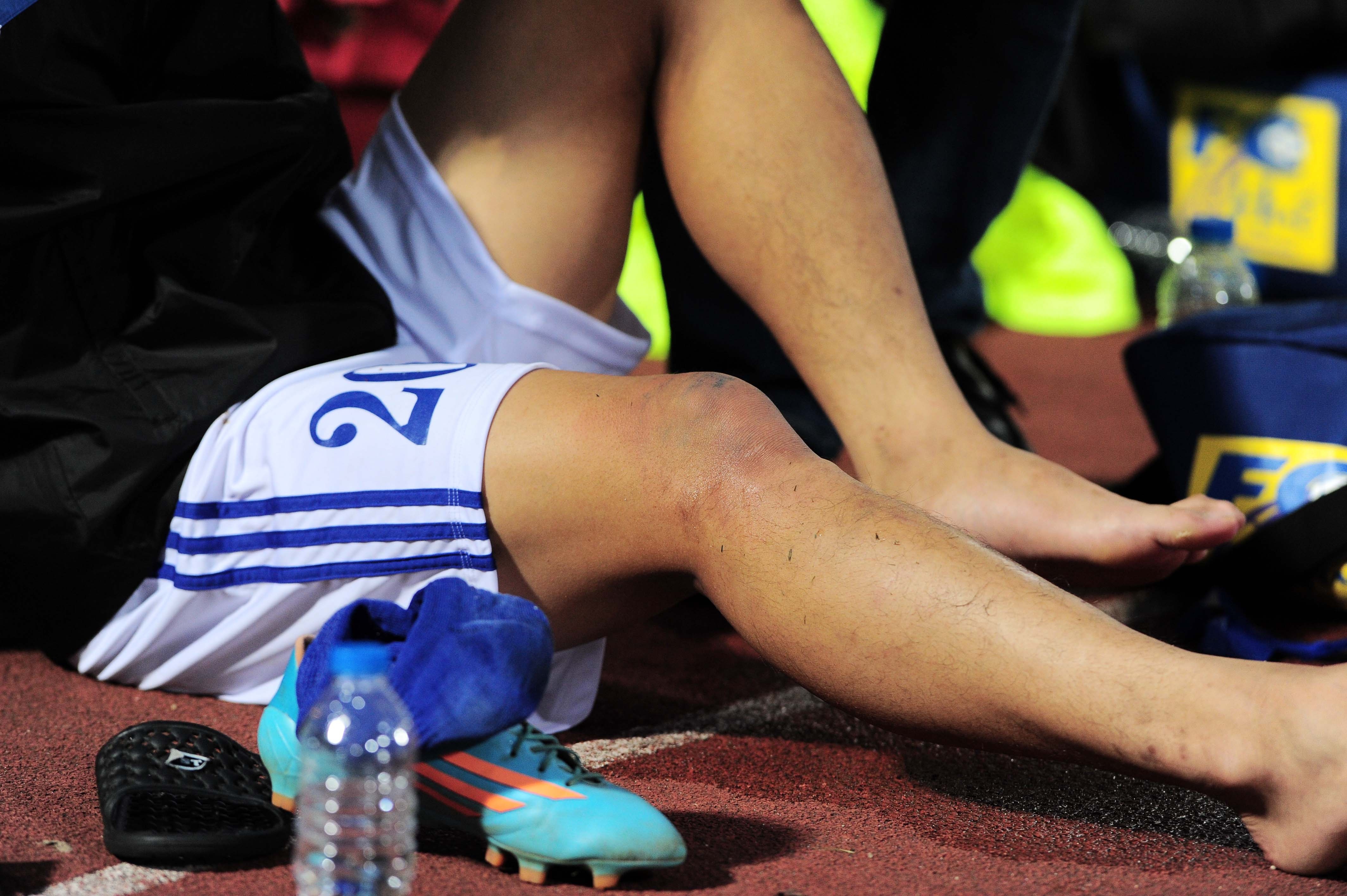 tien dao U19 Viet Nam chan thuong anh 5