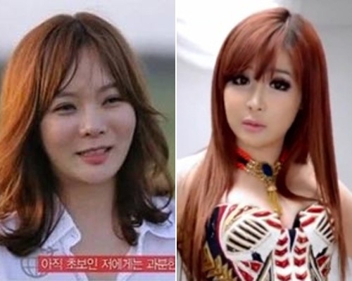 Park Bom, Chae Rim - tu xinh dep thanh 'tham hoa tham my' hinh anh