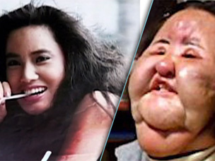 Nhung ngoi sao 'cuong' phau thuat tham my hinh anh