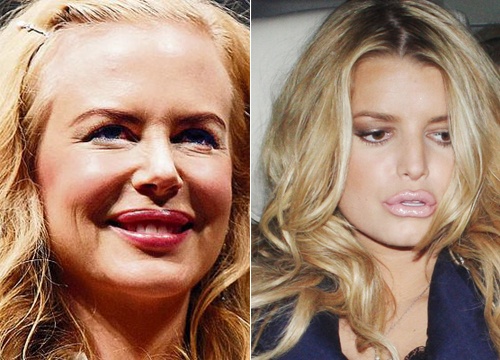 10 doi moi 'dao keo' tham hoa cua cac my nhan hinh anh