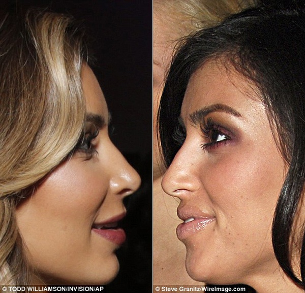 Kim ‘sieu vong 3’ lo mui dao keo thon gon hinh anh