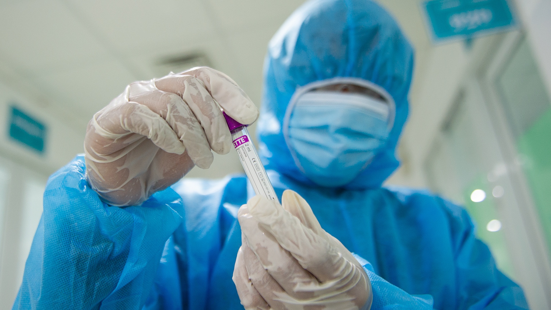 Chua tim ra F0 o o dich Hai Duong hinh anh