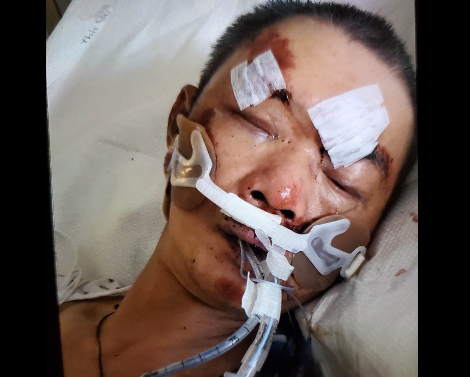 Nguoi dan ong goc Hoa bi da vao dau o New York hinh anh