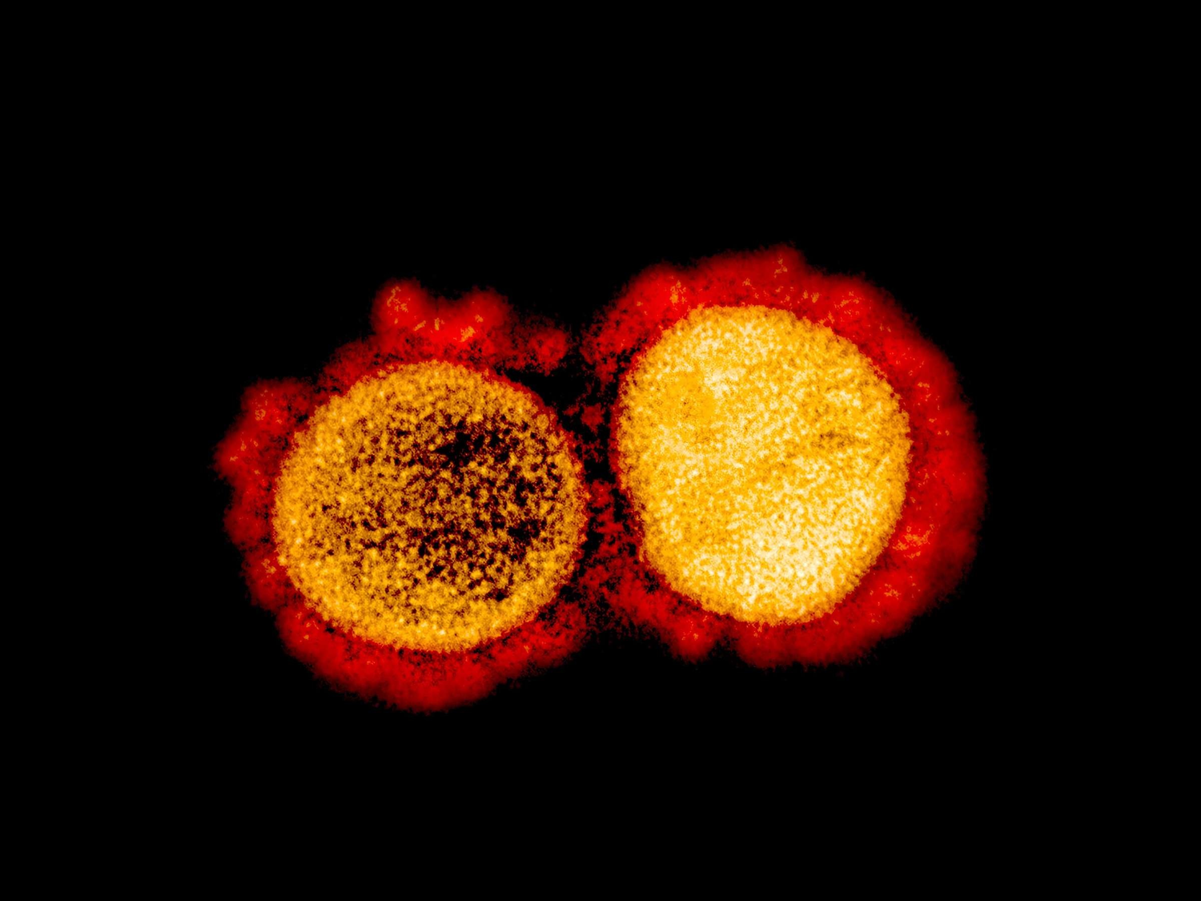 Philippines phat hien ca dau tien mac bien chung B.1.617.1 hinh anh