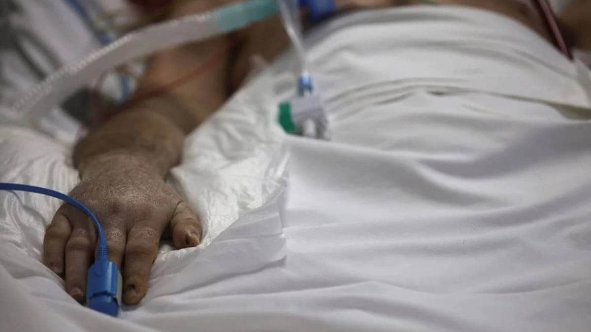 Phat hien chan dong ve su phan biet mau da o may do nong do oxy hinh anh