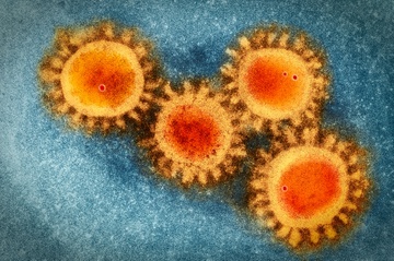 Nhung tin hieu tich cuc ban dau ve bien chung Omicron hinh anh