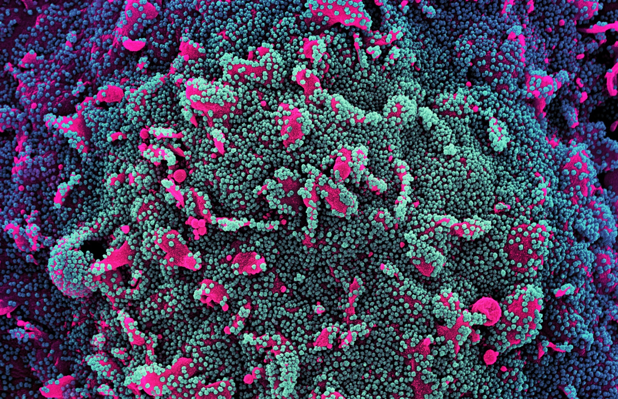 Phat hien khang the co the vo hieu hoa bien chung Omicron hinh anh