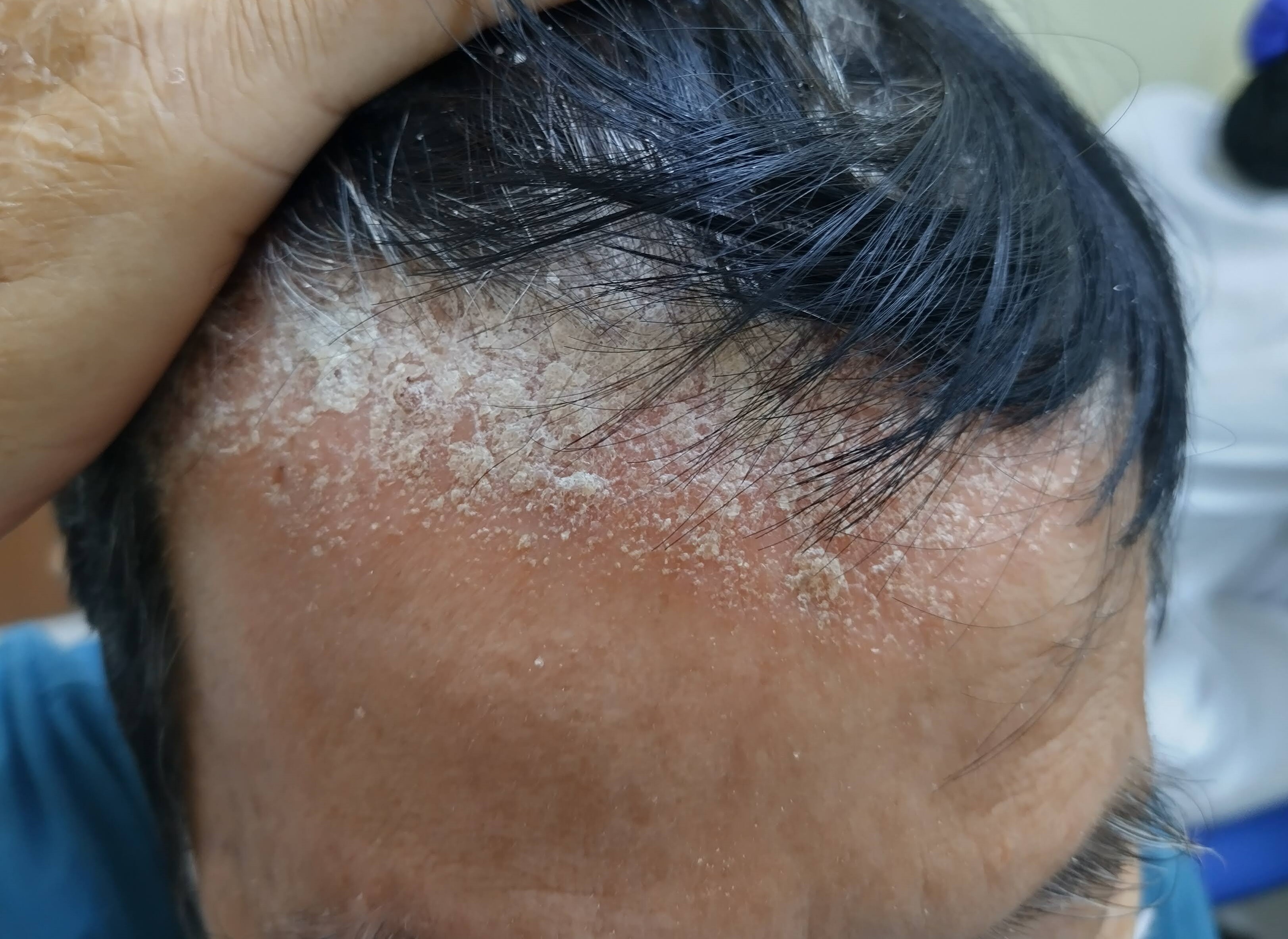 BVDK Tam Anh,  gau anh 1