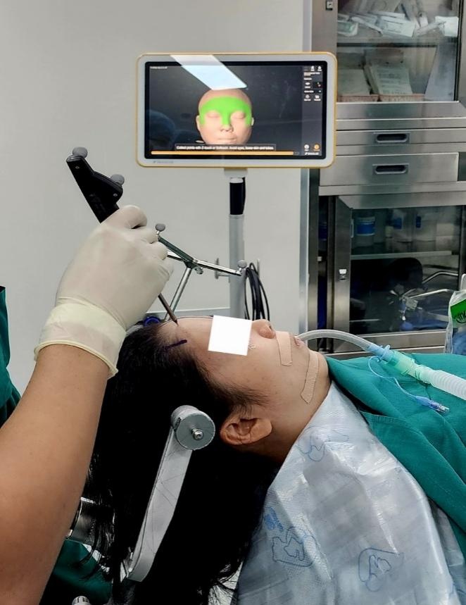 BVĐK Tâm Anh,  u não ảnh 4 BVDK Tam Anh,  u nao anh 4