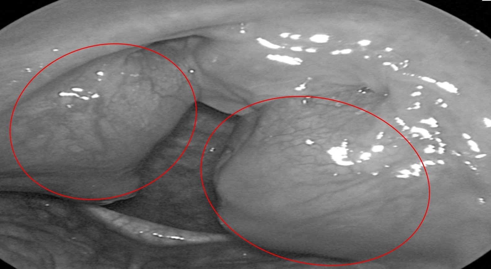 BVDK Tam Anh,  ngu ngay anh 1