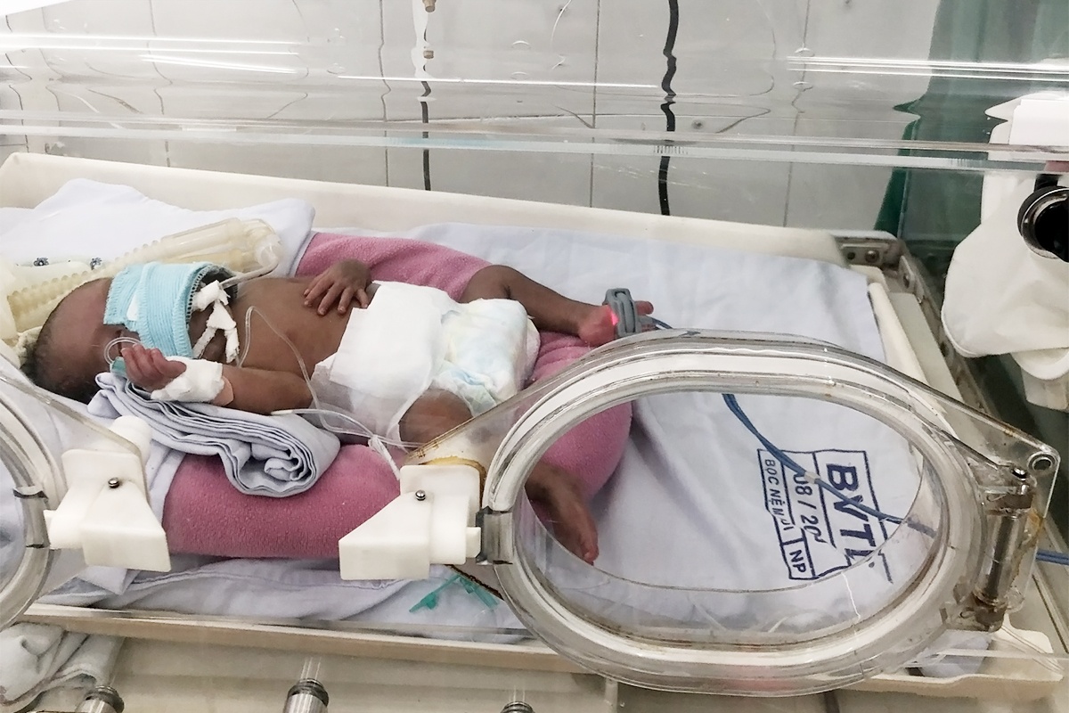 BVDK Tam Anh,  tre sinh non anh 2