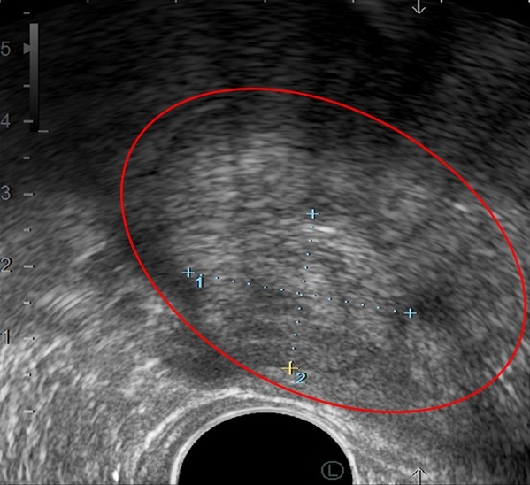 BVĐK Tâm Anh, bí tiểu ảnh 1 BVDK Tam Anh, bi tieu anh 1