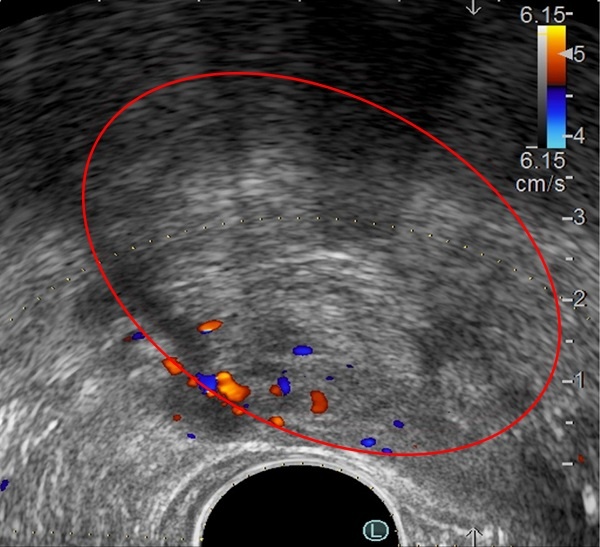 BVĐK Tâm Anh, bí tiểu ảnh 2 BVDK Tam Anh, bi tieu anh 2