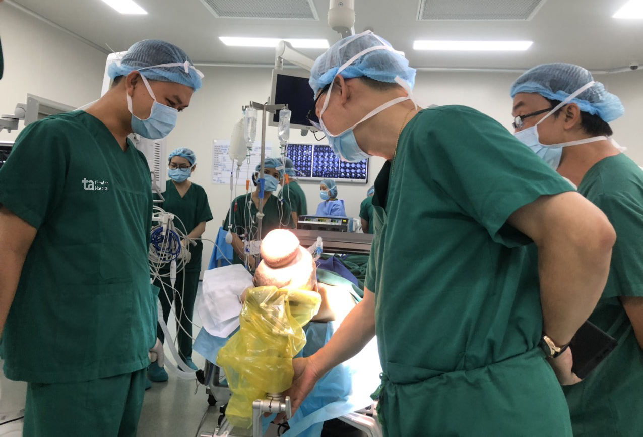 8 gio lay khoi u xuyen so va tai tao da hoai tu hinh anh