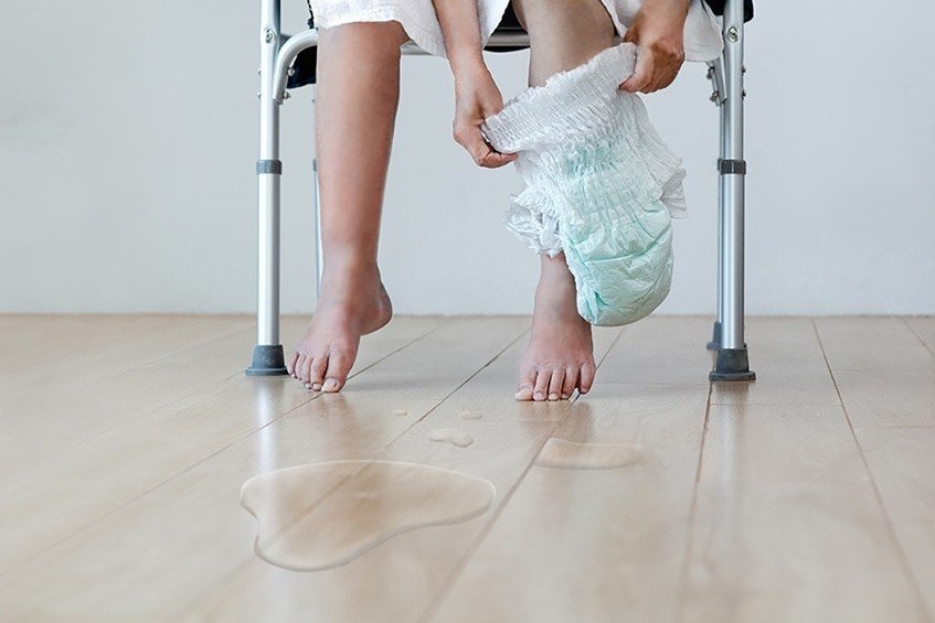 Bi son tieu keo dai hon 10 nam hinh anh