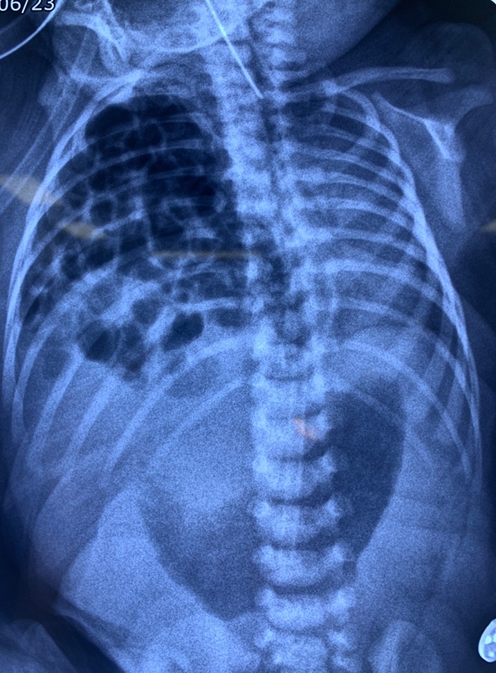 BVDK Tam Anh,  Ngoai Tim mach anh 1