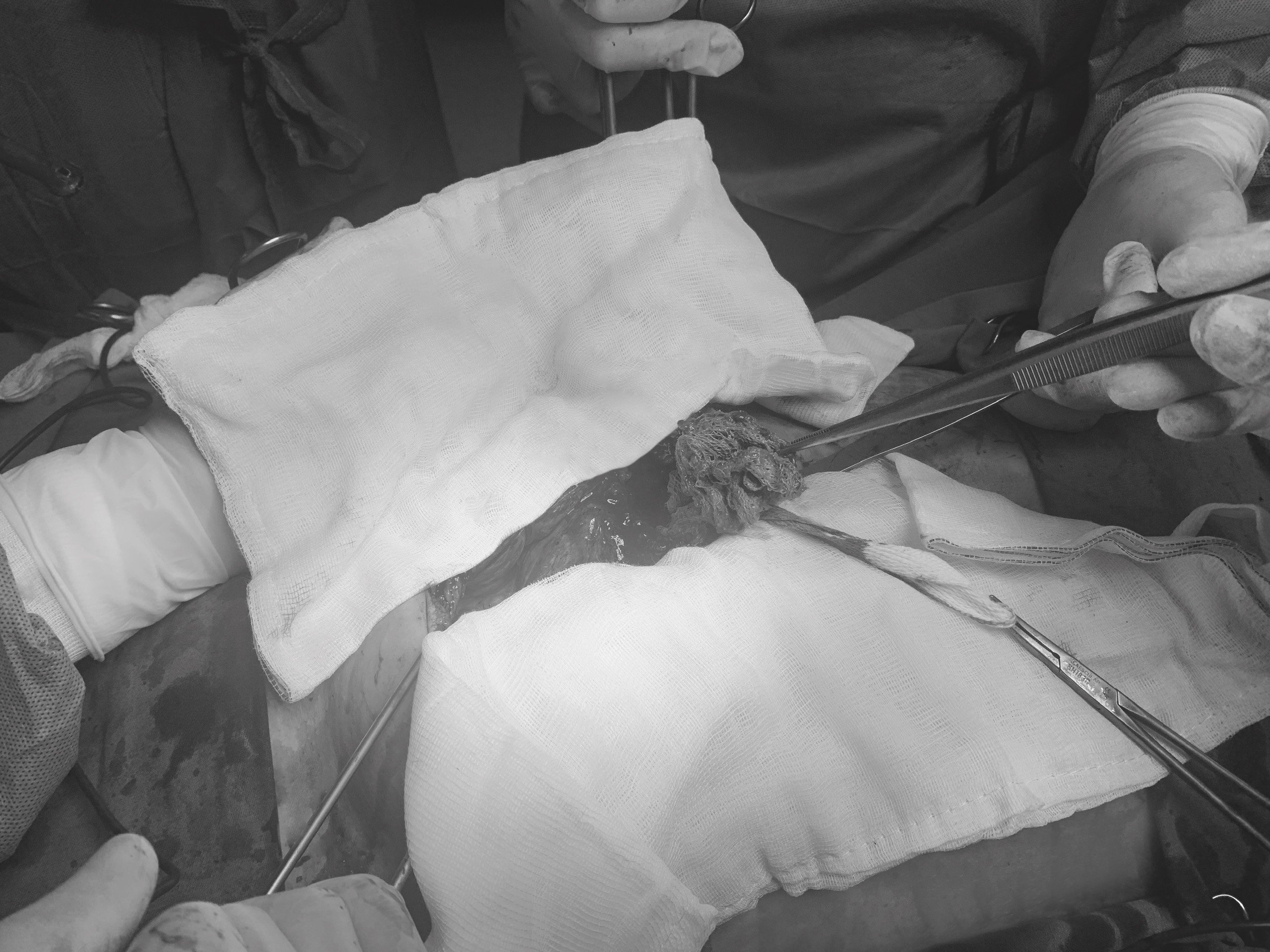 BVDK Tam Anh,  ban tac ruot anh 2