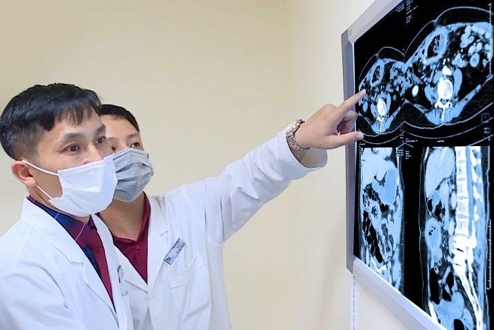 Phat hien bang gac bi bo quen 10 nam trong bung benh nhan hinh anh