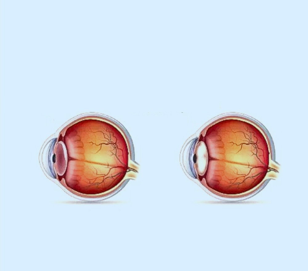 benh cuom kho,  Benh vien FV anh 1