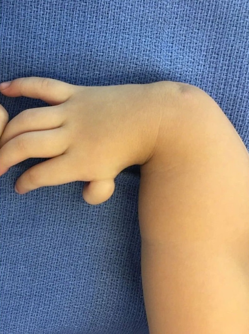 Benh vien FV,  thieu xuong quay anh 1