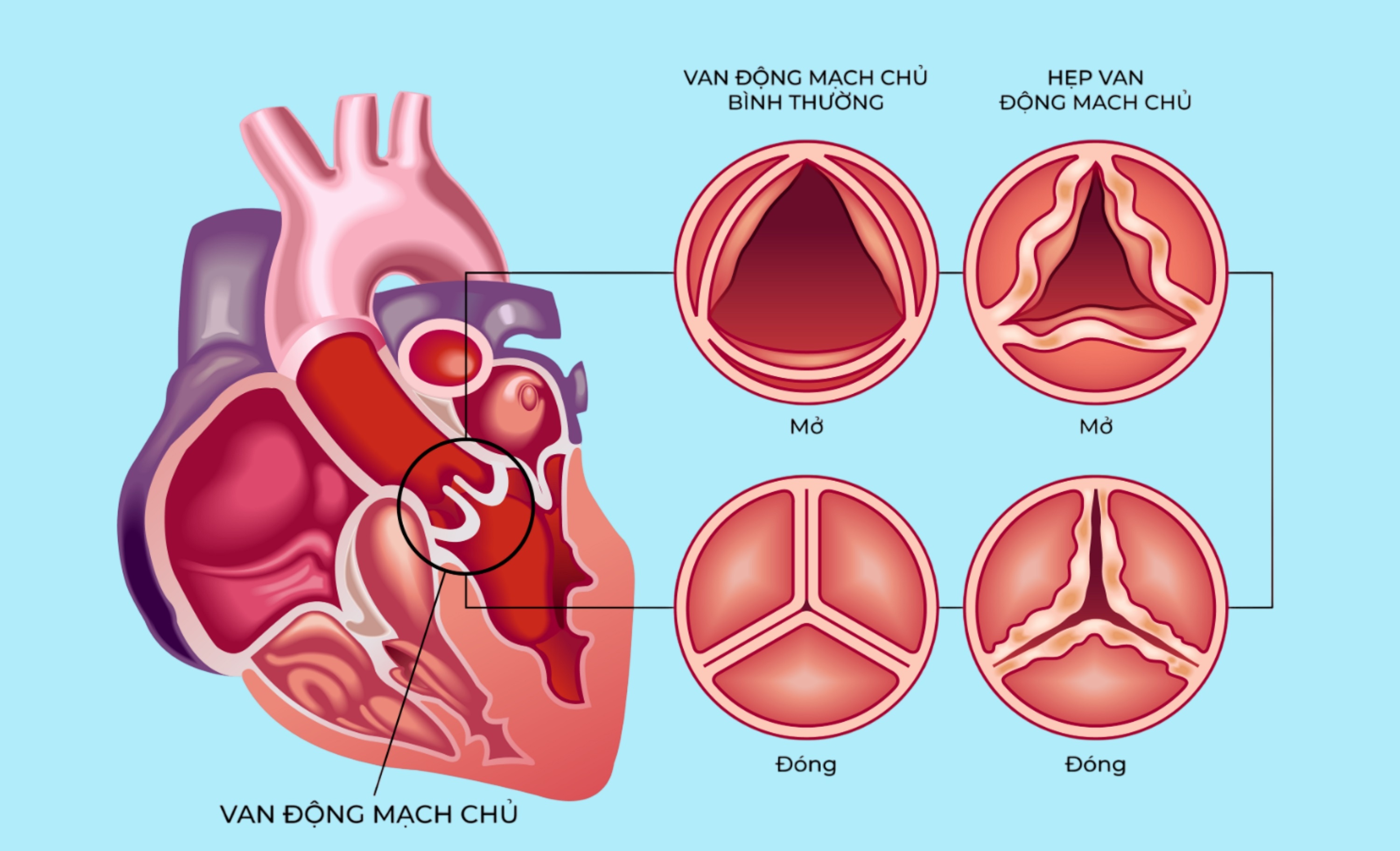 Benh vien FV,  Tim mach can thiep anh 1