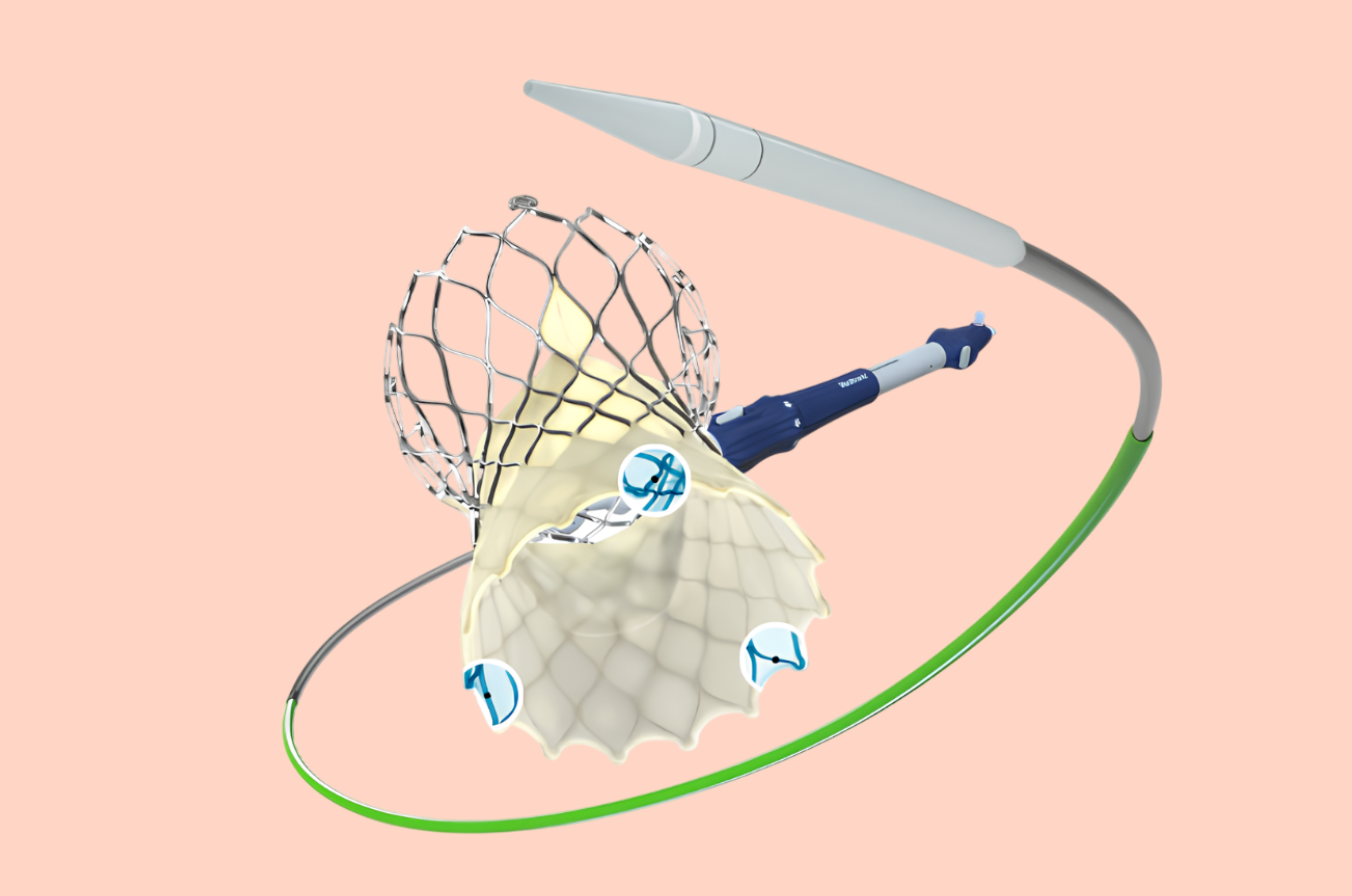 Benh vien FV,  Tim mach can thiep anh 2