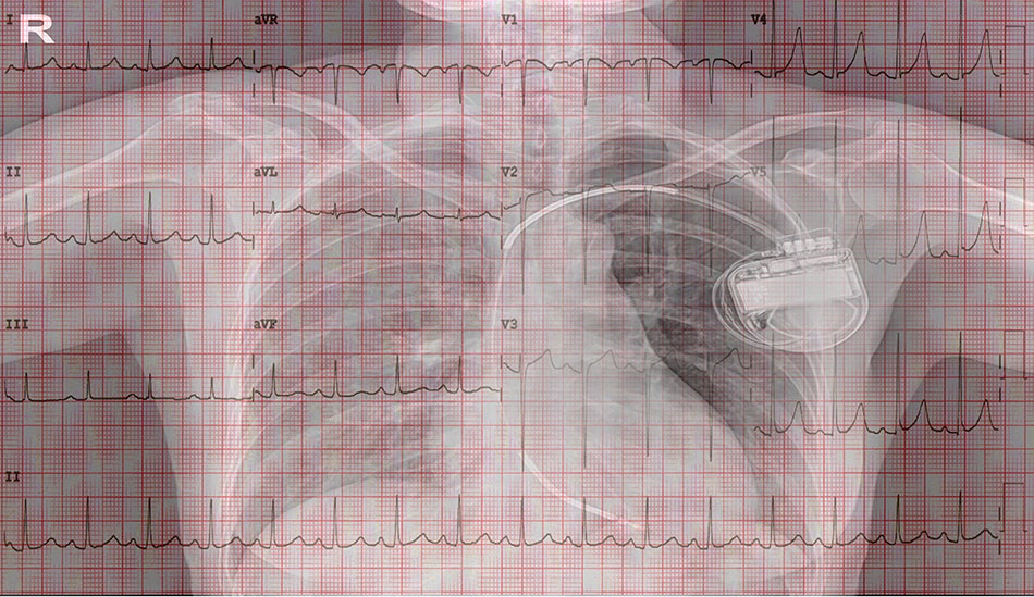 CRT ảnh 2 CRT anh 2