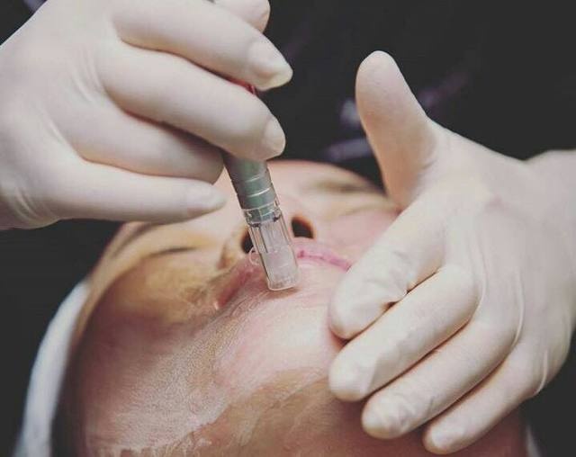 Hiểm họa khi cấy phấn cho da ảnh 2 Hiem hoa khi cay phan cho da anh 2