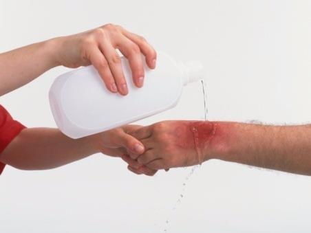 6 buoc can nho khi xu ly vet bong hinh anh