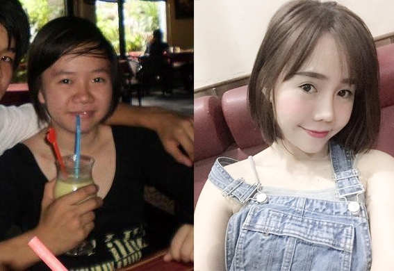 phẫu thuật thẩm mỹ ảnh 1 phau thuat tham my anh 1