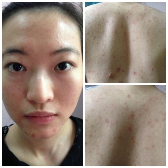 Phau thuat tham my anh 1