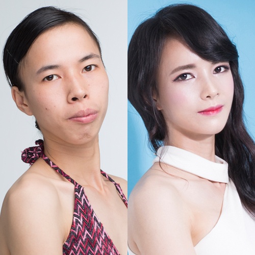 Phau thuat tham my anh 3