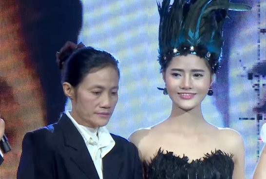 Phau thuat tham my anh 8