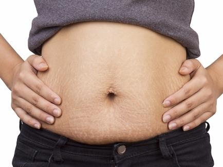 Vi sao sau sinh thuong beo bung? hinh anh