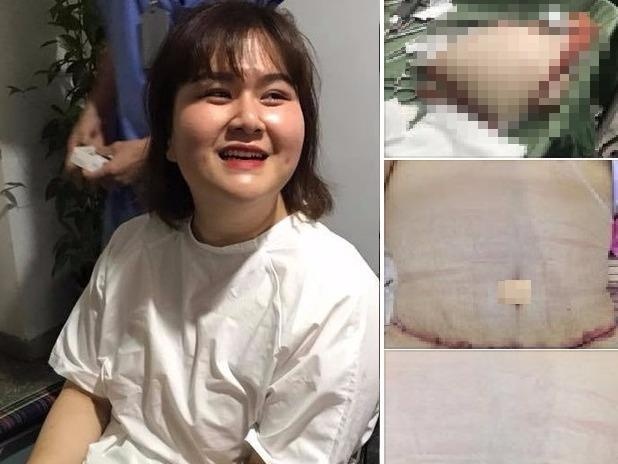 A quan Buoc nhay ngan can thuc hien dai phau cat mo vung bung hinh anh