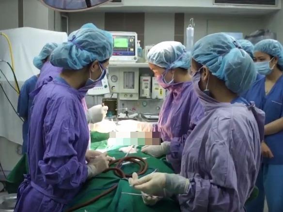 Hon 10 khoi u moc kin nguc vi bom silicon long nang cap vong mot hinh anh