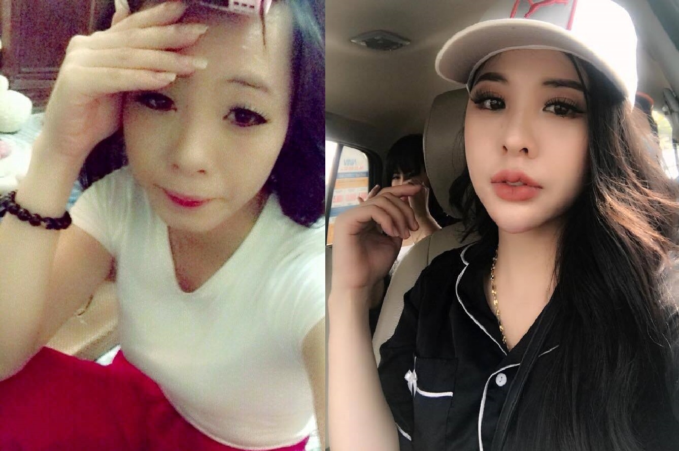 Phẫu thuật thẩm mỹ toàn bộ khuôn mặt ảnh 1 Phau thuat tham my toan bo khuon mat anh 1