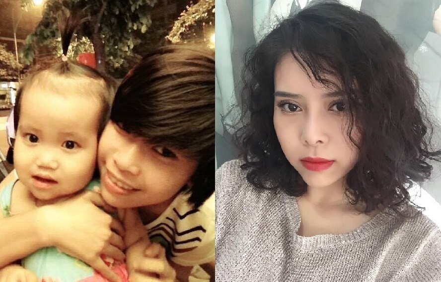 Kinh nghiem phau thuat tham my anh 1