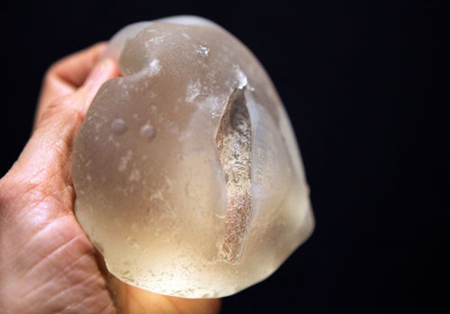 Phau thuat nang nguc uy tin anh 2