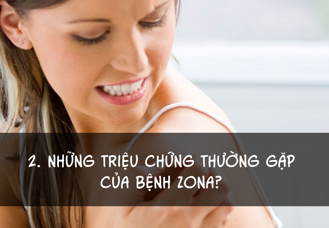 Cách điều trị bệnh zona ảnh 2 Cach dieu tri benh zona anh 2