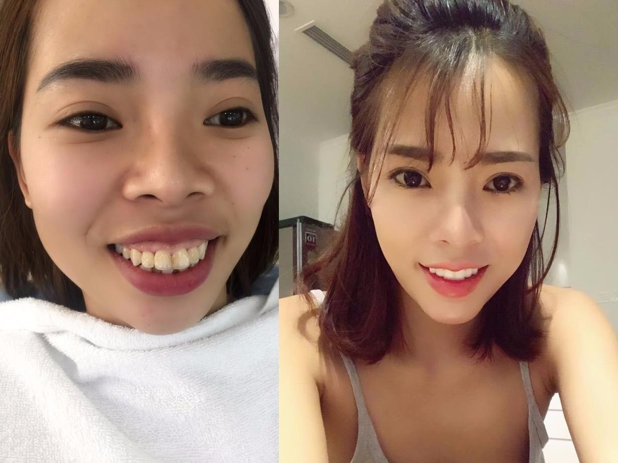 Co gai chi 200 trieu 'dao keo' khien nguoi than khong nhan ra hinh anh