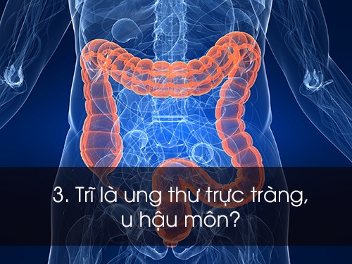 Cach chua benh tri anh 3