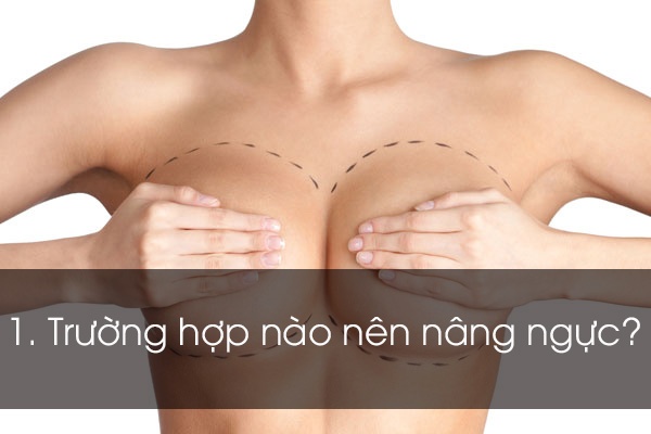 Điều cần biết khi nâng ngực ảnh 1 Dieu can biet khi nang nguc anh 1