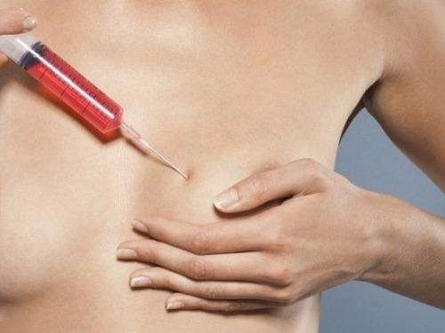 Nhung dieu can biet khi quyet dinh 'dao keo' vong mot hinh anh