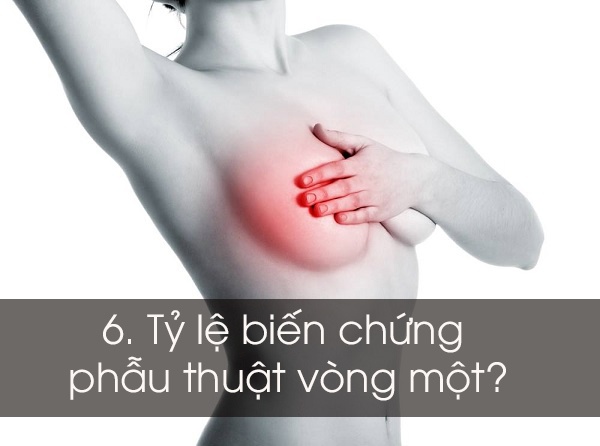 Điều cần biết khi nâng ngực ảnh 6 Dieu can biet khi nang nguc anh 6