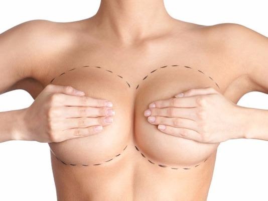 Bien phap keo dai tuoi tho vong mot sau khi 'dao keo' hinh anh