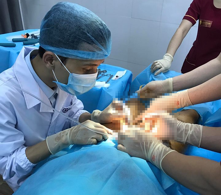 Qúa trình chuyển giới từ nam sang nữ ảnh 2 Qua trinh chuyen gioi tu nam sang nu anh 2