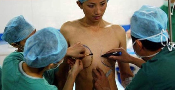 Quy trinh chuyen gioi tu nam sang nu nhu the nao? hinh anh